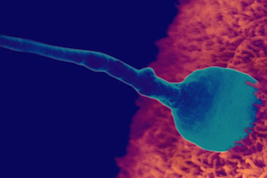 Как научиться стрелять спермой и почему она просто вытекает?